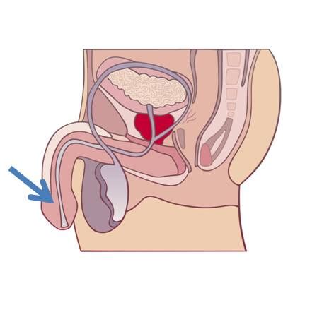 What can a person expect during a ct procedure? Penis