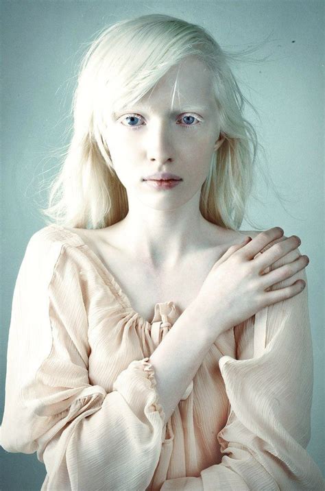 Snow White Modelo Albino Half Elf Albino Model Melanism Portraits