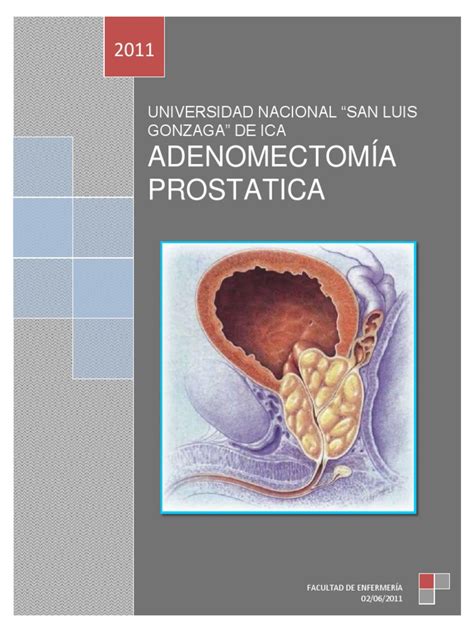 Adenomectomia Prostatica Prostate Cancer Urinary Bladder