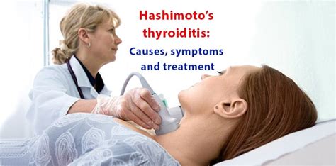 What Is Hashimotos Thyroiditis Causes Symptoms And Treatment