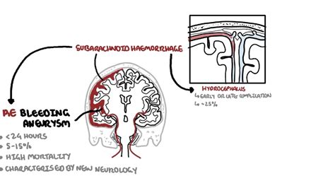 Subarachnoid Haemorrhage Pathophysiology Complications And