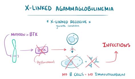 X Linked Agammaglobulinemia