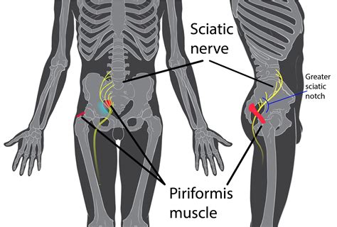 Have Sciatic Nerve Pain Try This Super Easy Remedy To Get Rid Of It