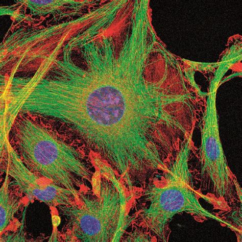 Cell Culture Reagents & Cells - Immuno Diagnostic