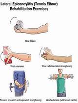 Exercises For Tennis Elbow