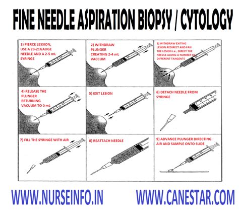 Fine Needle Aspiration Cytology Pdf Role Of Fine Needle Aspiration