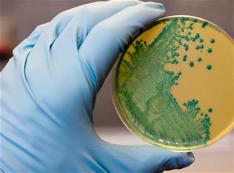 Listeria monocytogenes is a ubiquitous microorganism responsible for listeriosis, a rare but severe disease in humans, who can become infected by ingesting contaminated food products, namely dairy. LISTERIA MONOCYTOGENES - Ecamricert