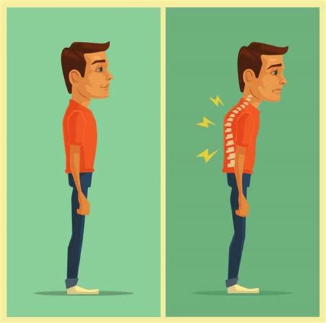 Bad Posture Effects Causes And Fixes The Bodywise Clinic