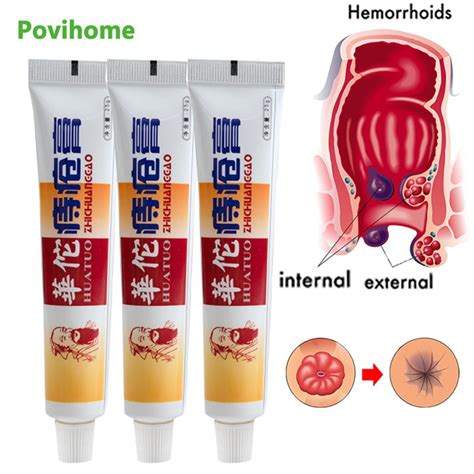 1 3 5pcs chinese hemorrhoid medical ointment external internal hemorrhoids relief anal swell