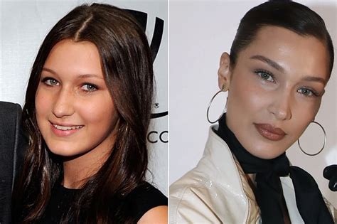 celebs who are unrecognizable after having plastic surgery page 21 of 42 misterstocks