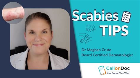 Dermatologist Recommended Scabies Tips Youtube