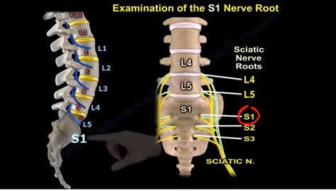 Examination Of S1 Nerve Root —