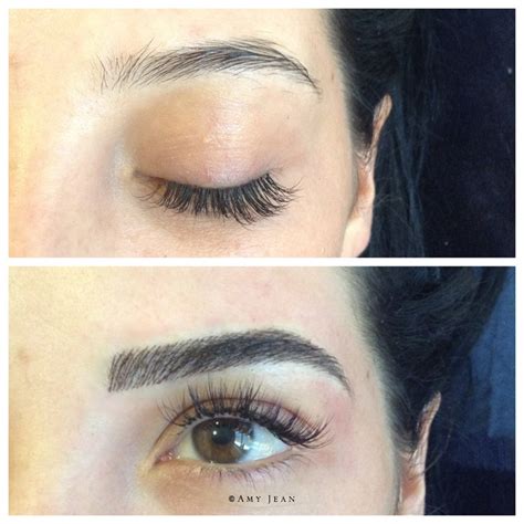 With cryosurgery, the skin is frozen and the ink burned off with liquid nitrogen. The Ultimate Guide to Tattoo Eyebrows: What Exactly Are They?