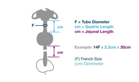 G Jet Low Profile Button G J Tube Balloon Feeding Tube