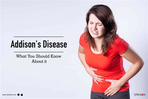 Addison S Disease What You Should Know About It By Dr K Sridhar Lybrate