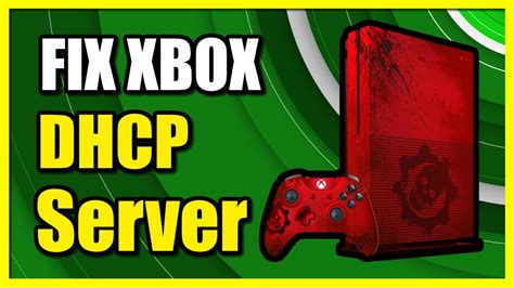How To Fix Can T Connect To DHCP Server On Xbox One Network Easy Tutorial YouTube