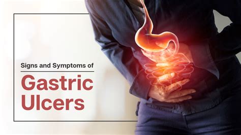 Gastric Ulcers Signs Symptoms Causes And Treatments