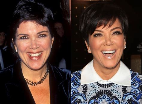 Kris Jenner Perfect Plastic Surgery For 59 Years Old Mother
