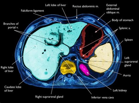 Liver Anatomy Ct Radiology Schools Radiology Medical School Studying
