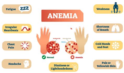 What S Anemia Causes Symptoms Treatments SunExport