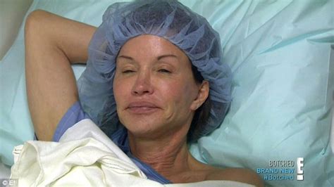 Janice Dickinson Makeup Free As Botcheds Dr Terry Dubrow Blasts Her As Difficult Patient