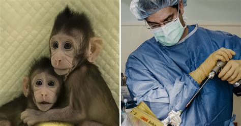 Scientists Implanted A Human Brain Gene Into Monkeys Small Joys