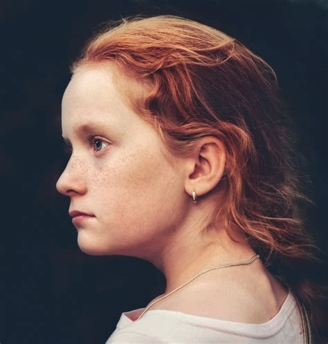 we love freckles photo contest winners