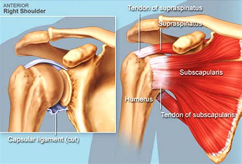 Provides static restraint with arm in 90° of abduction and external rotation. What's Wrong With My Shoulder?