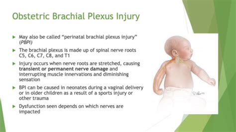 Obstetric Brachial Plexus Injury Week Flashcards Quizlet