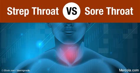 strep throat versus sore throat