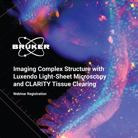 Bruker Webinar Imaging Complex Structure With Light Sheet Microscopy