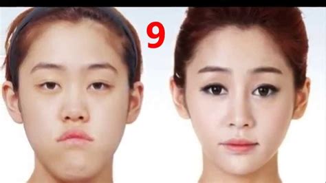 Amazing Plastic Surgery Before And After Plastic Surgery