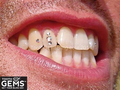 Awesome Sparkle Diamond Teeth Tooth Gem Dental Jewelry
