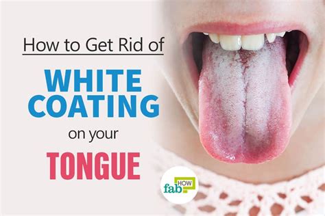 How To Get Rid Of A White Coated Tongue With Just 1 Ingredient White Tongue White Coated