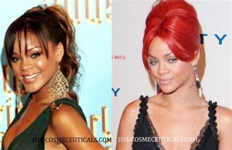 Rihanna Skin Lightening Reellana
