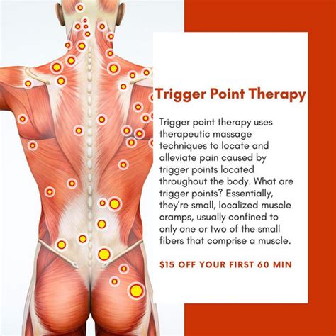 Trigger Point Therapy At Balance Orlando