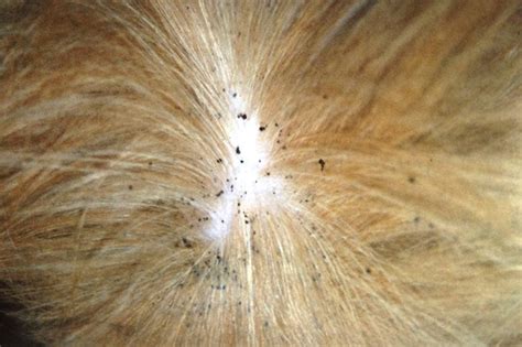 Do bed bugs carry diseases like ticks, fleas or other pests? How to Tell if Your Dog Has Fleas: 6 Simple Ways to Find ...