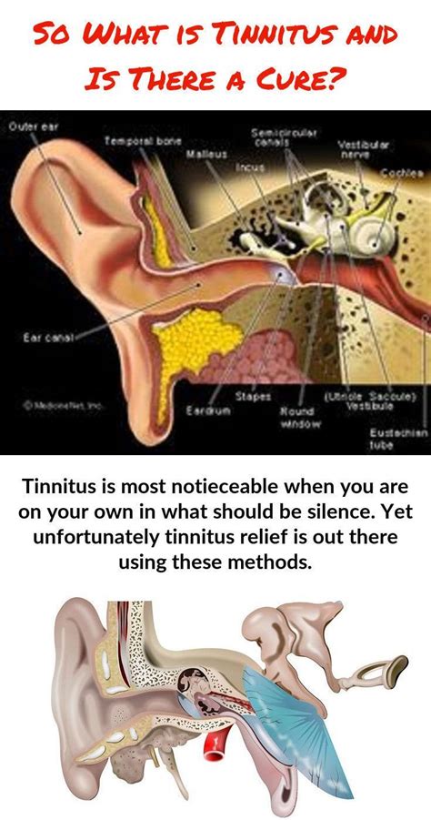 The Very First Step In Dealing With Tinnitus Is Discovering What May Be