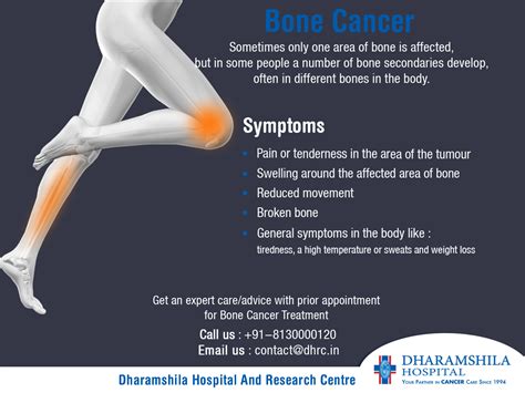 Surgery to remove a tissue sample for testing. Sintomas De Cancer De Huesos - SEO POSITIVO