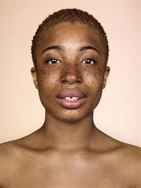 Freckles Brock Elbanks Striking Portraits In Pictures Pessoas Com