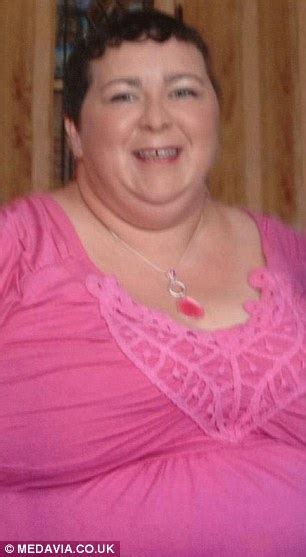 Obese Ireland Woman Who Covered Her 20st Frame Loses Half Her Weight