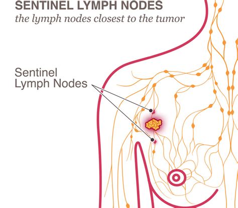How Many Lymph Nodes Are In The Body Examples And Forms