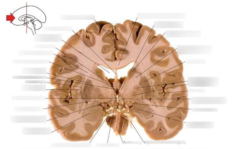 The Rostral Surface Of A Coronal Section Of Brain Through The Level Of