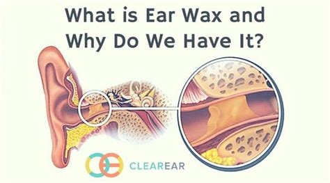 What Is Ear Wax And Why Do We Have It Oto Tip Ear Wax Ear Wax