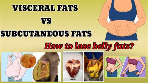 How To Lose Belly Fats Subcutaneous Fats Vs Visceral Fats Youtube