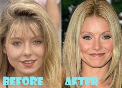 Kelly Ripa Plastic Surgery Before And After Pictures Lovely Surgery