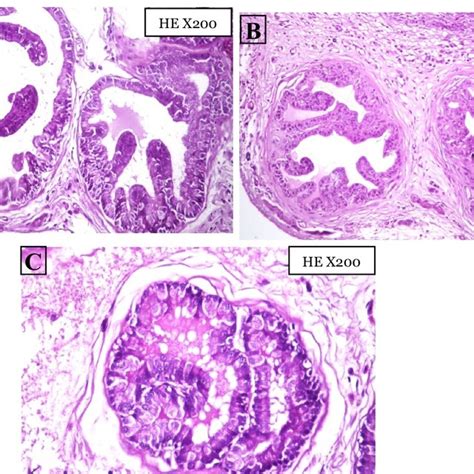Photomicrograph Cross Sections Of The Prostate Gland For Treated Download Scientific Diagram