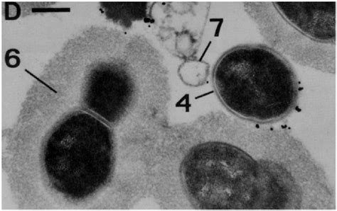 Electron Micrograph Of Streptococcus Pneumoniae And The Associated