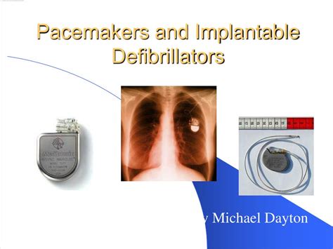 Ppt Defibrillator Pacemakers And Icd Powerpoint Presentation Free SexiezPix Web Porn