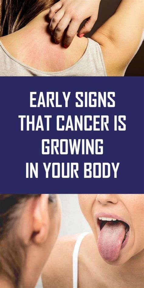 Early Warning Signs Cancer Is Growing Inside Your Body Natural